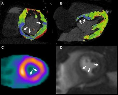 2011 02 22 16 00 47 200 Weininger 61 Yr Old 450