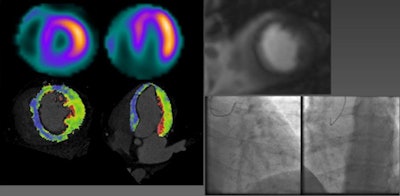 2011 02 22 16 00 50 29 Weininger 50 Yr Old 450