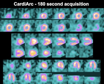 2011 02 28 12 08 17 310 Cardi Arc 3min Image 450