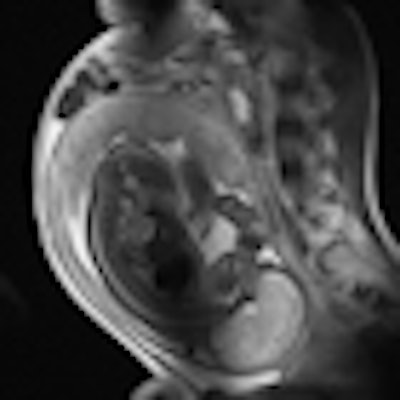 2011 03 02 13 14 30 802 2011 03 05 Pregnant Thumb