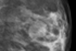 2011 03 02 22 58 33 925 2011 03 04 Bi Rads3 Thumb