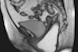 2011 03 02 23 45 43 822 2011 03 04 Pelvic Thumb