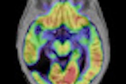 2011 03 03 17 10 45 381 2011 03 04 Siiemens Mr Ibrain Thumb