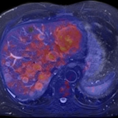 2011 03 03 17 10 47 817 2011 03 04 Siemens Mr Iliver