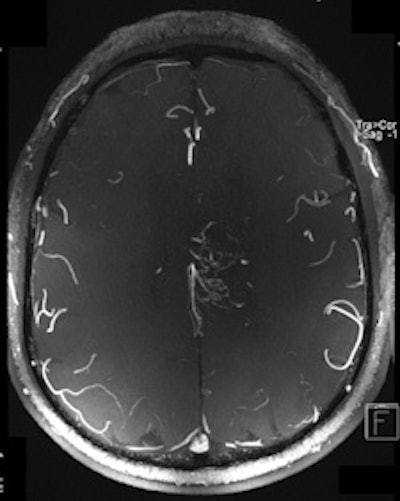 2011 03 04 13 24 22 351 2011 03 06 7 T Mri Right