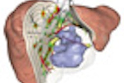 2011 03 06 21 27 17 159 2011 03 07 Mevis Thumb