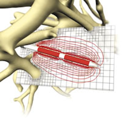 2011 03 06 21 27 17 336 2011 03 07 Mevis Rfa