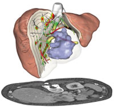2011 03 06 21 27 17 622 2011 03 07 Mevis Liver