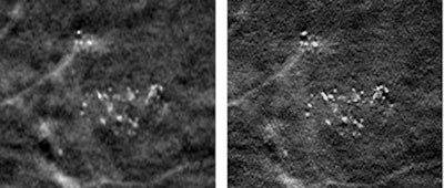 2011 03 09 16 21 28 852 Dbt Spie 450