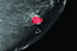 2011 03 24 13 31 28 88 Speed Of Sound Overlay Thumb