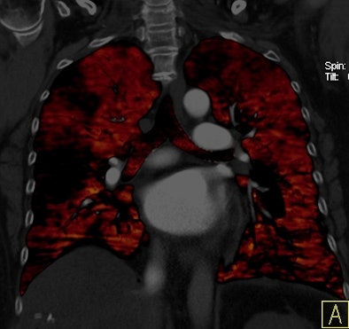 2011 03 31 11 59 17 196 Bauer Top 394