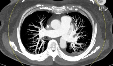 2011 03 31 11 59 20 8 Bauer 6th