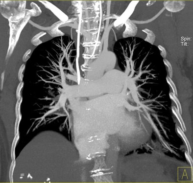 2011 03 31 11 59 21 148 Bauer 5th