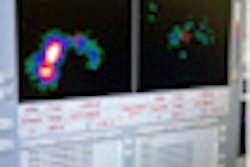 2011 04 01 14 37 57 563 Gamma Camera Procedure Thumb