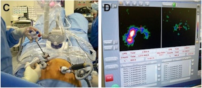 2011 04 01 14 37 59 52 Gamma Camera Procedure 450
