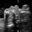 2011 04 07 15 02 11 113 3 Dus A Thumb