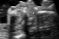 2011 04 07 15 02 11 113 3 Dus A Thumb