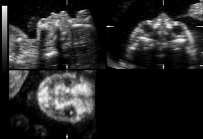 2011 04 07 15 02 11 273 3 Dus A 394