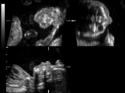 2011 04 07 15 02 12 827 3 Dus B 394