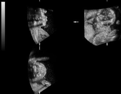 2011 04 07 15 02 13 475 3 Dus C 394