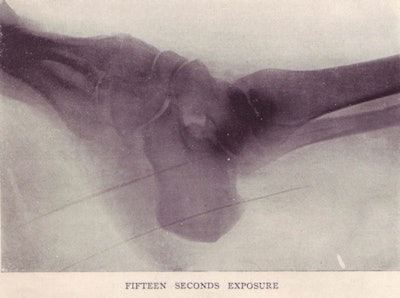 2011 04 08 10 49 02 193 Kinraide Coil Scan0014 450