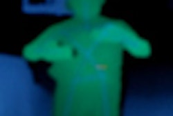 2011 04 12 14 43 40 862 Kinect Thumb