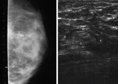 2011 04 21 15 54 16 567 Wang Fat Graft Fig2 450