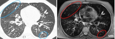 2011 04 25 13 27 47 76 Ciet false mri Periphery 450