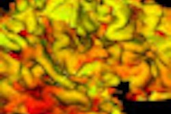 2011 05 02 15 23 25 709 Autism Mri Thumb