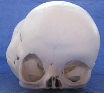 2011 05 04 11 59 29 958 Reuss skull top