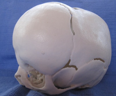 2011 05 04 11 59 31 934 Reuss skull bottom