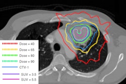 2011 05 11 14 00 56 747 Estro Clinical 394