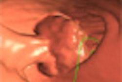 2011 05 20 14 52 06 769 Cash thumb Comp