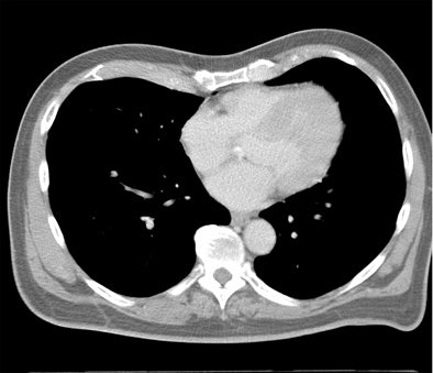 Thoracic image