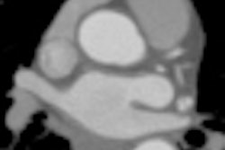 2011 05 25 14 15 44 325 Budoff thumb2 05 2011