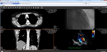 Client Outlook’s eUnity software enables browser-based review of diagnostic-quality images. Image courtesy of Client Outlook.