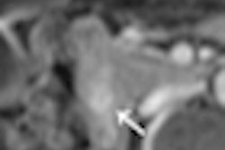 2011 06 01 15 30 58 9 2011 06 02 Mri Ct Pancreas Thumb