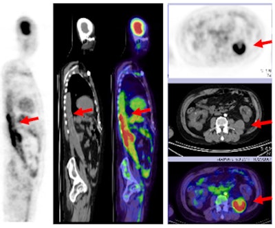 2011 06 07 09 54 41 495 Fever Unknown Origin 450