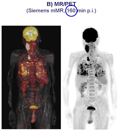 2011 06 07 11 04 03 177 Petmri 80min Bottom 394