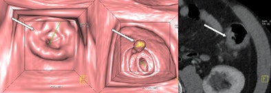 2011 06 15 09 54 33 394 Graser top