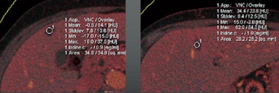 2011 06 15 09 54 36 724 Graser bottom