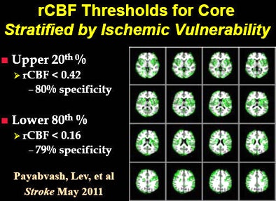 A new study maps the areas of greater ischemic vulnerability, shown in green. All images courtesy of Dr. Michael Lev.