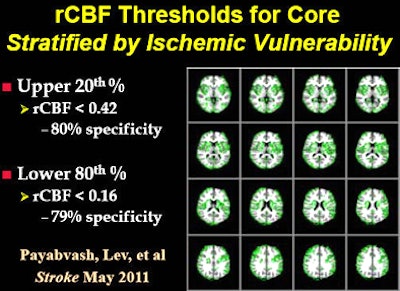 A new study maps the areas of greater ischemic vulnerability, shown in green. All images courtesy of Dr. Michael Lev.