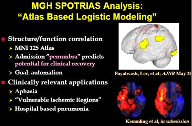 MGH's atlas-based logistic modeling project aims to model outcomes probabilities in specific brain regions in stroke patients.