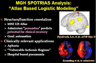 MGH's atlas-based logistic modeling project aims to model outcomes probabilities in specific brain regions in stroke patients.