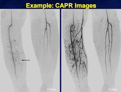 2011 06 16 11 45 45 464 Capr Slide18 450