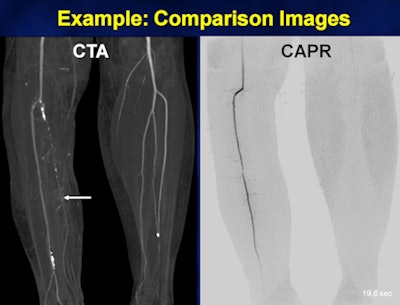 2011 06 16 11 45 50 554 Cta Capr Slide16 450