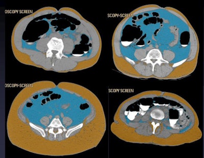 2011 06 20 14 09 06 581 Pickhardt visc fat four images