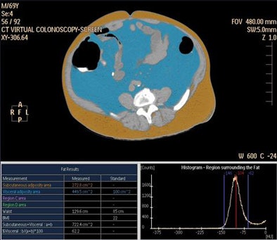 2011 06 20 14 09 11 885 Pickhardt fat tool gui