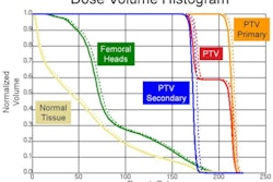 2011 06 21 13 28 22 419 Dose Volume Histogram 394